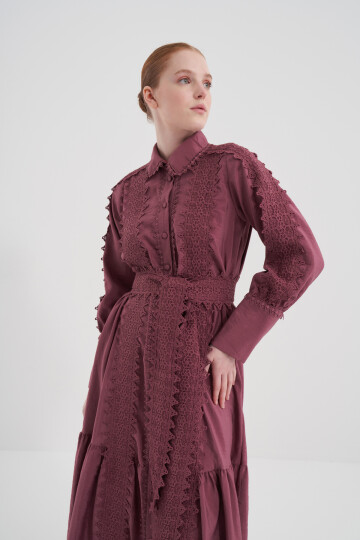 Buttoned Laced Dress